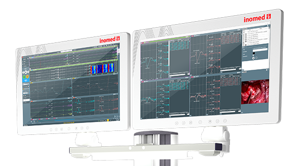 Foto: Monitor mit NeuroExplorer 8 Foto: Monitor mit NeuroExplorer 8