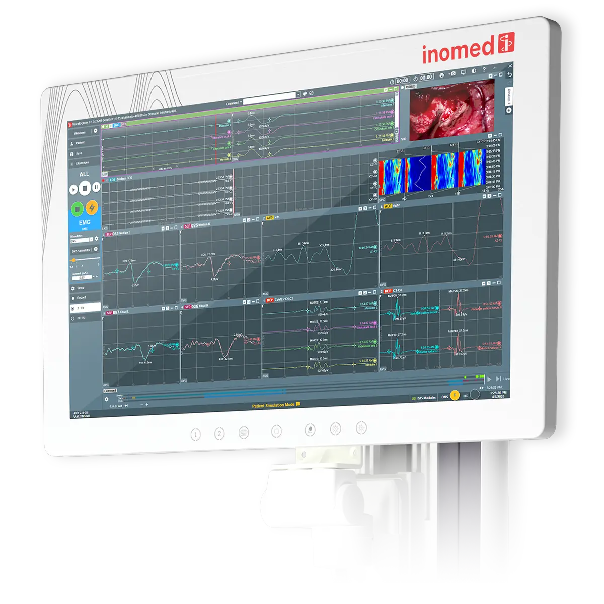 ISIS Xpert® ISIS Xpert®