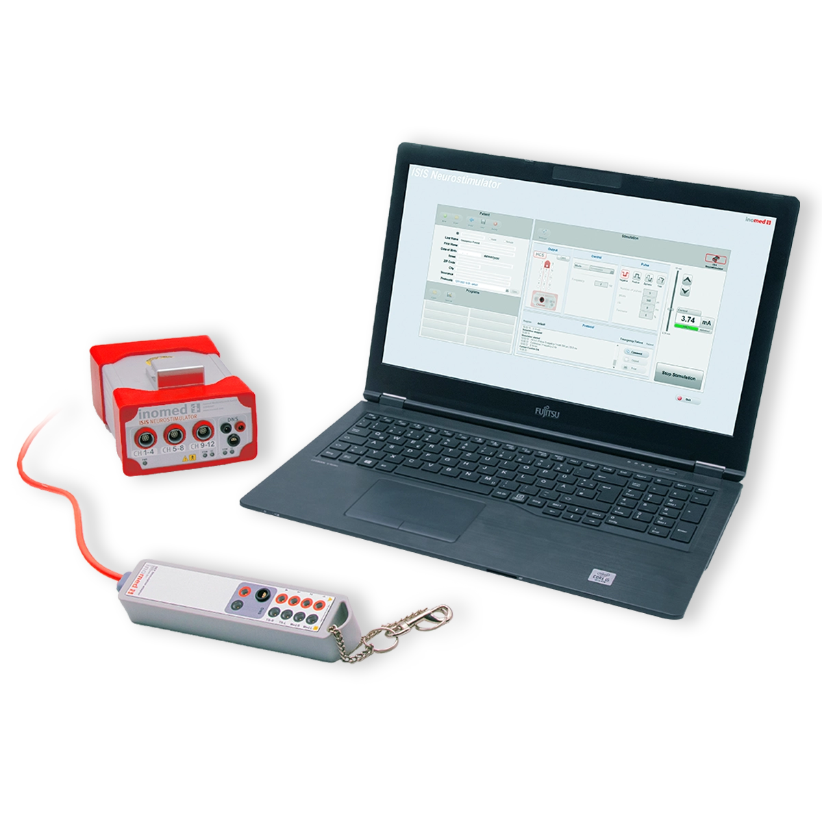 ISIS Neurostimulator ISIS Neurostimulator