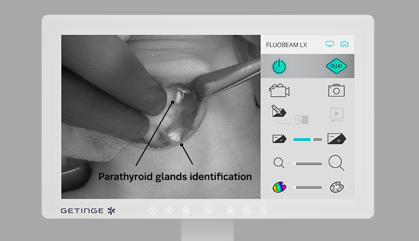 Foto: FLUOBEAM LX Touchscreen Foto: FLUOBEAM LX Touchscreen