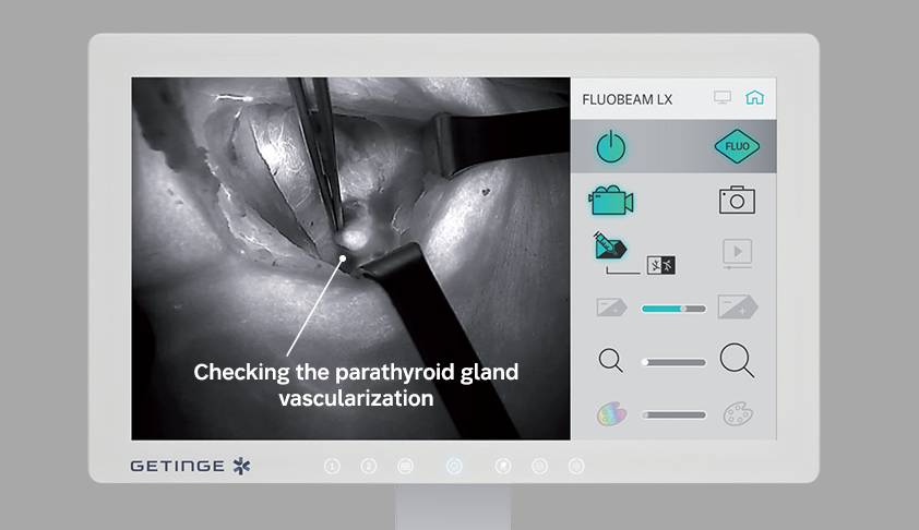Foto: FLUOBEAM LX Touchscreen mit ICG-Anzeige Foto: FLUOBEAM LX Touchscreen mit ICG-Anzeige