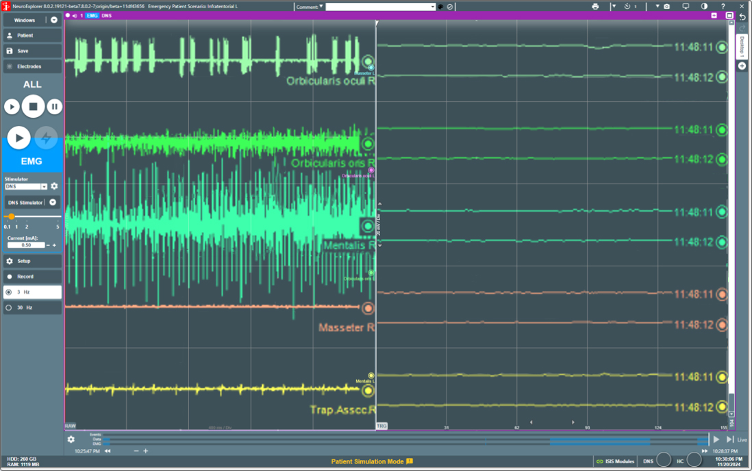 EMG Aktivität EMG Aktivität