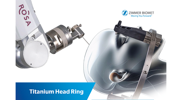 Abbildung: ROSA ONE® Brain mit Kopfringeinheit Abbildung: ROSA ONE® Brain mit Kopfringeinheit