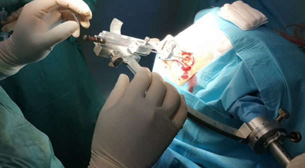 Funktionelle Neurochirurgie Link: Produkte Funktionelle Neurochirurgie