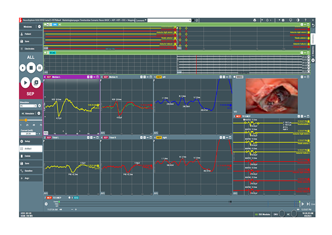 Video-Schnittstelle für ISIS IOM inkl. Software und Hardware Video-Schnittstelle für ISIS IOM inkl. Software und Hardware