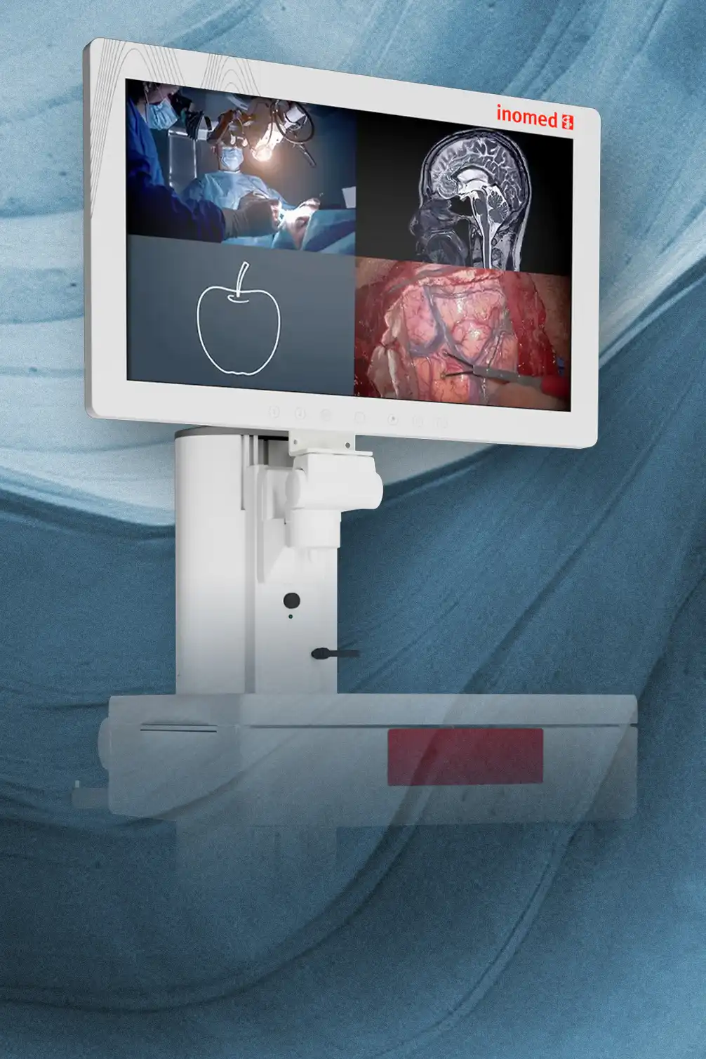 Zeitgleiche Anschlussmöglichkeit von 4 Videoquellen