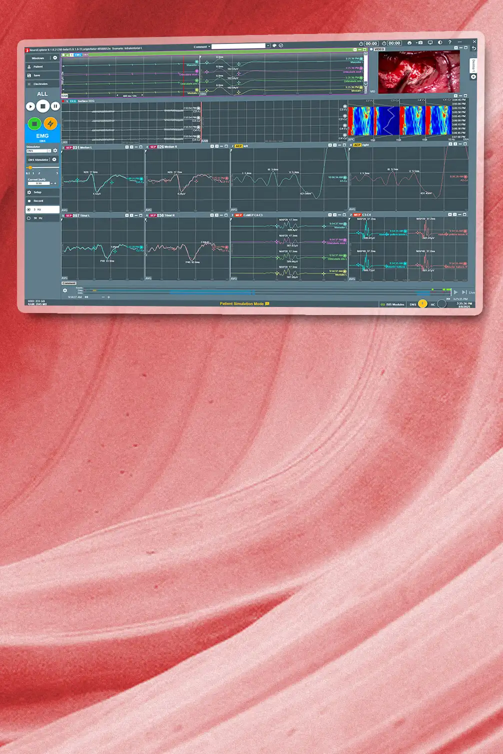 NeuroExplorer 8.1 Foto: ISIS Xpert plus mit NEX8