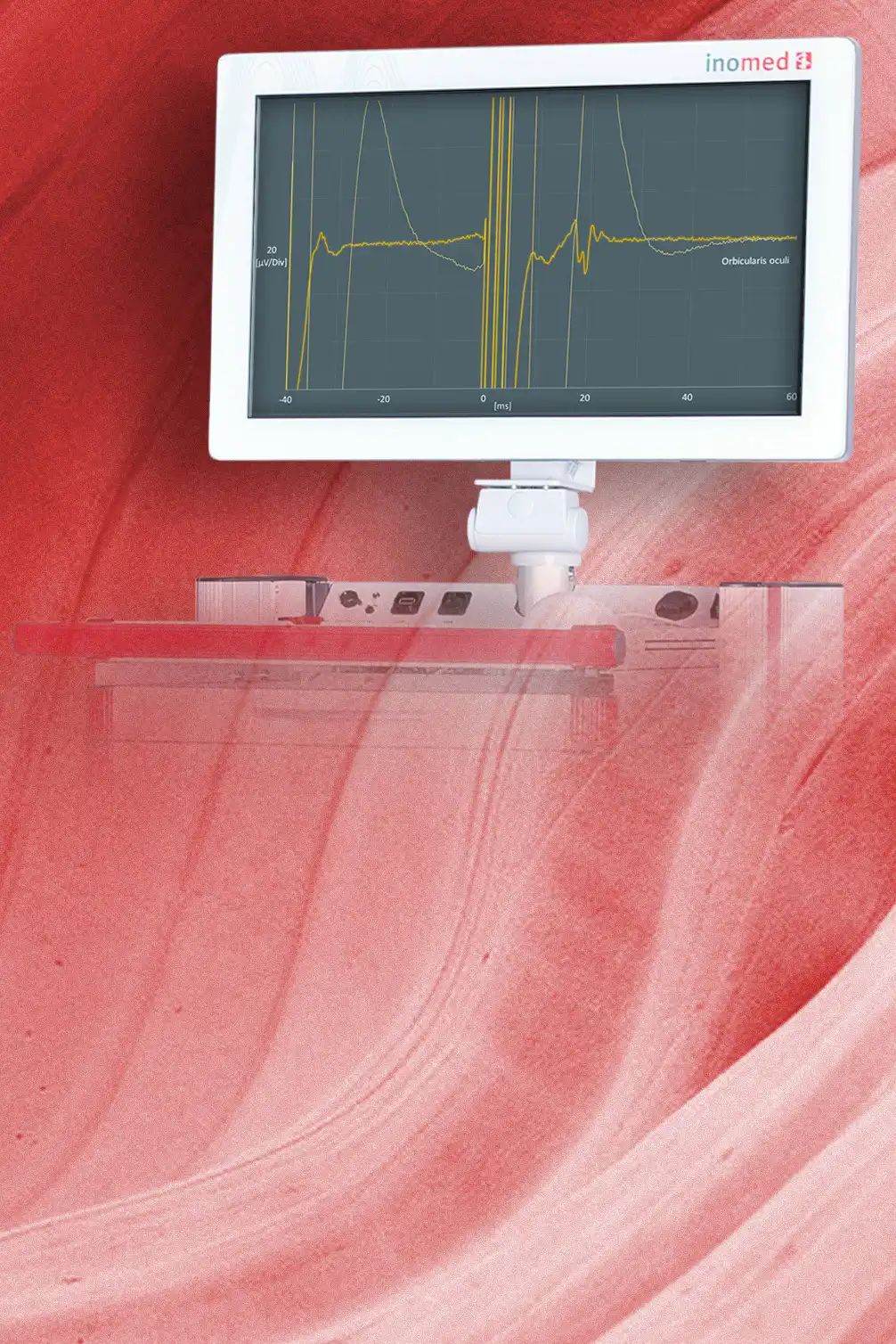 Deutschlandweit patentierte Technologie zur Stimula­tionsartefaktunterdrückung