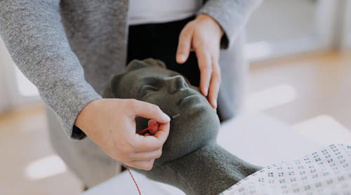 IONM in neurosurgery | EN Link: Schulung von ARKANA