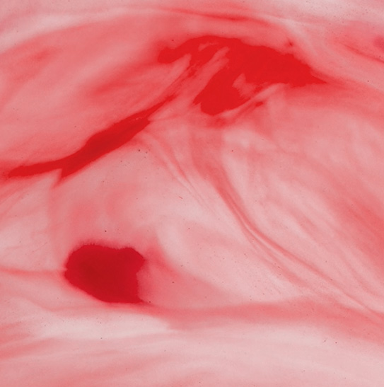 IONM für OP-Personal Link: Schulungen bei inomed